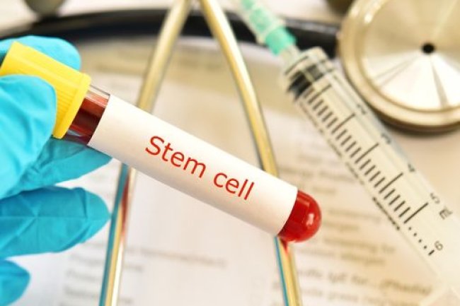 Causes of High Diabetes -Blood Sugar